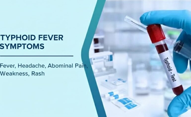 Typhoid Fever Symptoms What You Need to Know