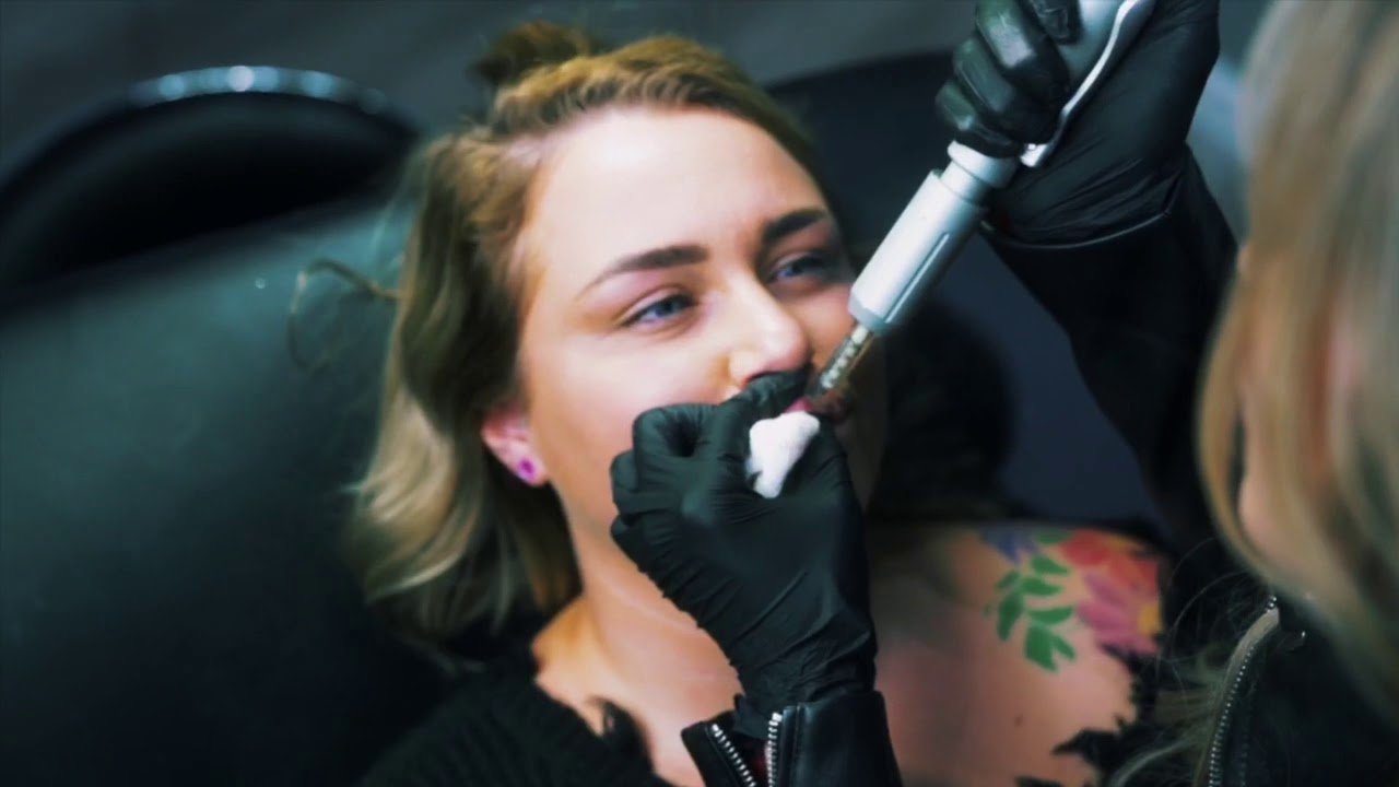 Needleless Lip Filler Results: What Users Really Experience