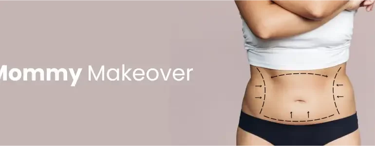 Mommy Makeover Cost with Liposuction: Complete Expert Guide